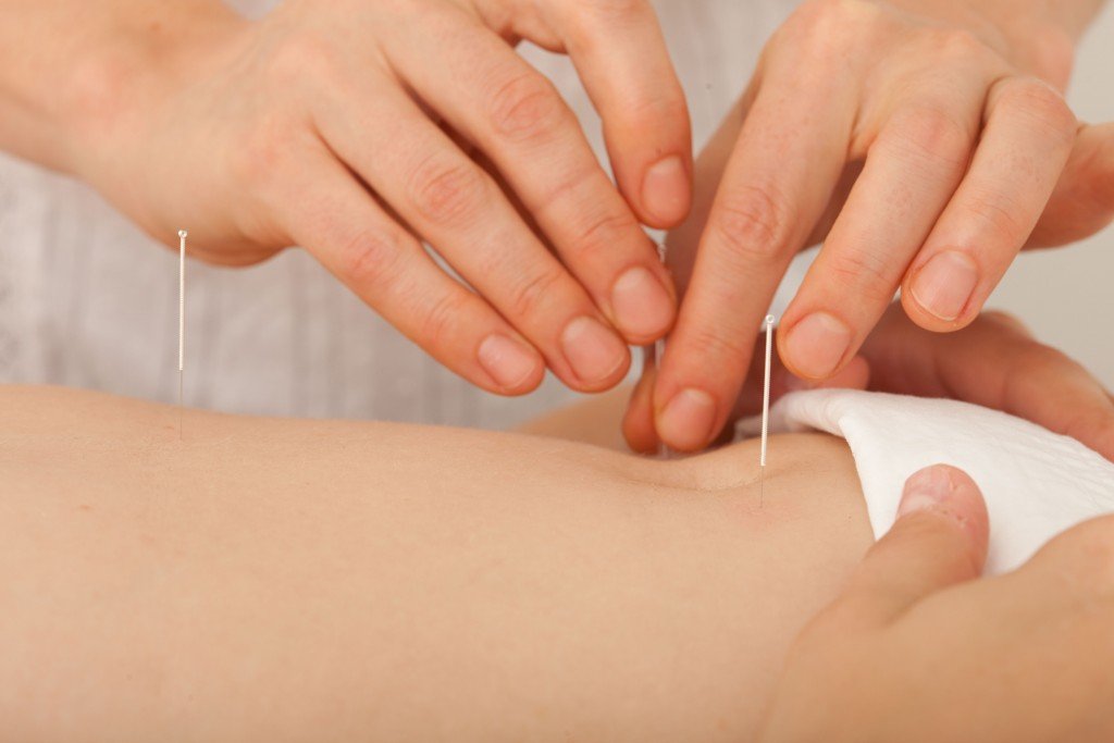 La acupuntura Triple + Moxa Alivia el dolor menstrual