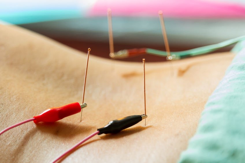 La acupuntura repara los nervios lesionados