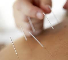 La acupuntura reduce el dolor en la cirugía del columna